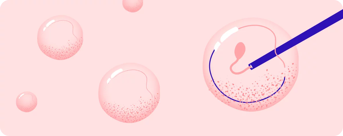 Opakovaný pokus o oplodnění hero-image