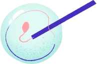 Tentativi ripetuti di fecondazione assistita hero-image