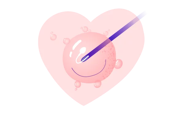 Mimotělní oplodnění image