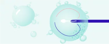 Umělé oplodnění hero-image