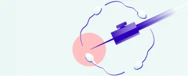 PESA/MESA/TESE: Získání spermií chirurgickou cestou hero-image