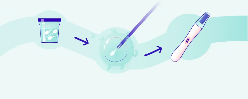 Jak probíhá umělé oplodnění? hero-image