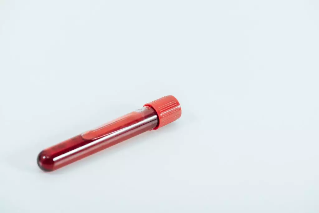 Tento obrázek nemá vyplněný atribut alt; název souboru je europeivf.com-k-cemu-slouzi-geneticke-vysetreni-paru-pred-pocetim-test-tube-with-blood-sample-on-white-surface-2022-03-31-17-55-37-utc-1024x683.jpg.